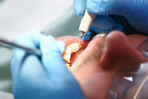 Best Tooth Infection Emergency Dentist  in Doe Valley, KY