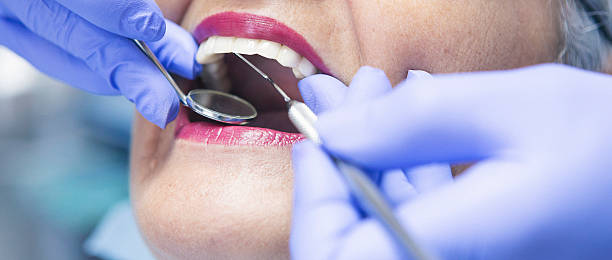 Best Knocked-Out Tooth Emergency  in Doe Valley, KY